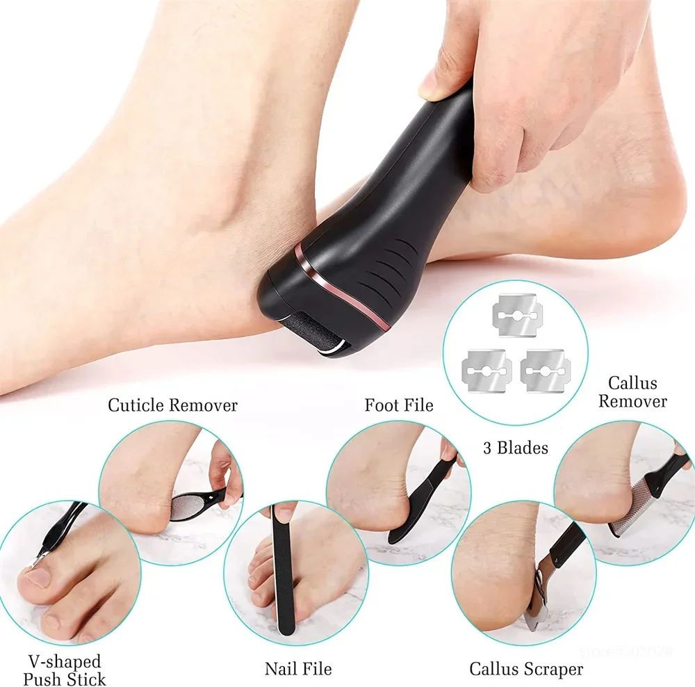 Electric Callus Remover – Smooth Feet in Minutes with Pedicure Foot File