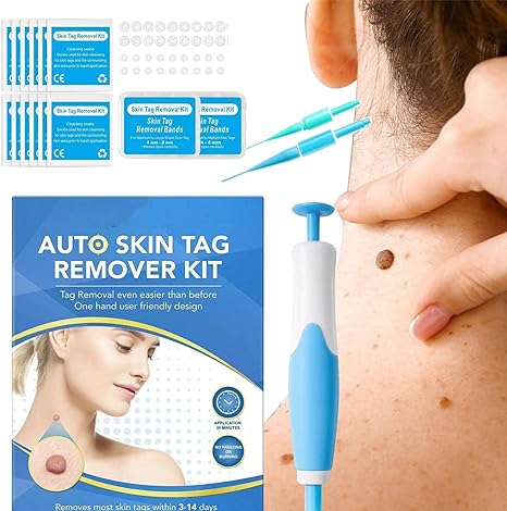 Acrochordon Skin Remover Kit – Safe & Effective Skin Tag Removal