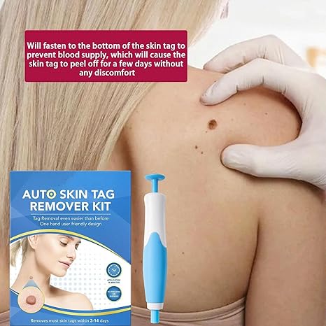 Acrochordon Skin Remover Kit – Safe & Effective Skin Tag Removal