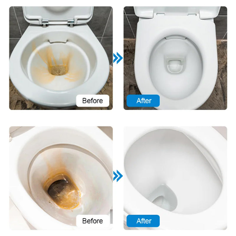 🔥New Japanese cleaning technology👉Powerful Toilet Bowl Cleaner Tablets💥Get 50% to 70% off for a limited time!